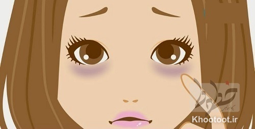 معجزه ای برای تیرگی دور چشم خانمها و آقایان معجزه ای برای تیرگی دور چشم خانمها و آقایان
