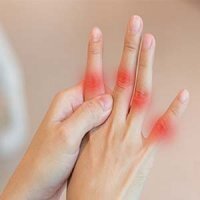 رایج ترین نشانه های ابتلا به «نقرس» چیست؟ رایج ترین نشانه های ابتلا به «نقرس» چیست؟