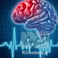 در مواجهه با سکته مغزی چه کنیم؟ در مواجهه با سکته مغزی چه کنیم؟