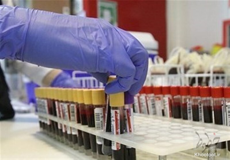 ساخت دستگاه ضروری پرتودهی خون برای بیماری‌های خونی