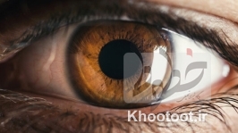 سلول‌های اهدایی چشم پس از مرگ بینا شد