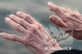چرا نورونها با بیماری پارکینسون میمیرند؟ چرا نورونها با بیماری پارکینسون میمیرند؟