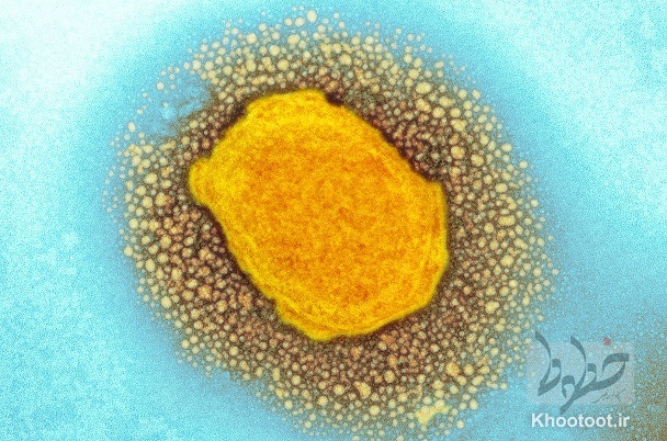 ویروس آبله میمون که در اینجا در یک میکروگراف الکترونی رنگی نشان داده شده است