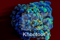 ویروس HIV بدن را زودتر پیر می‌کند