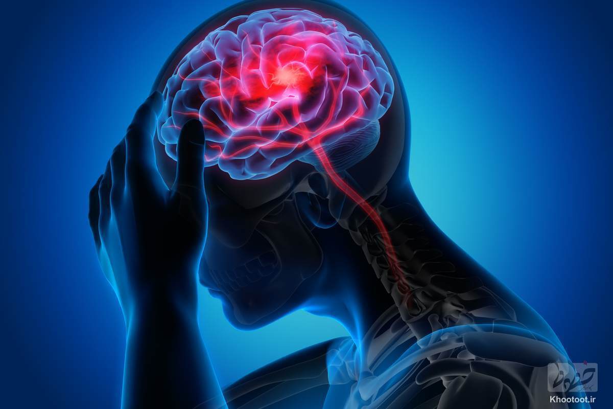نشانه‌ها و راه‌های درمان سکته مغزی