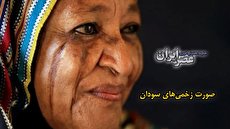 ببینید| صورت زخمی&zwnj;ها در سودان/ سنت عجیبی که در آن با تیغ به جان صورت می&zwnj;افتند