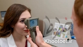 امکان تشخیص اوتیسم برای اولین بار با بررسی مردمک چشم