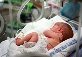درمان رایگان ۲۲۰ نوزاد مبتلا به بیماری‌های مادرزادی نخاع