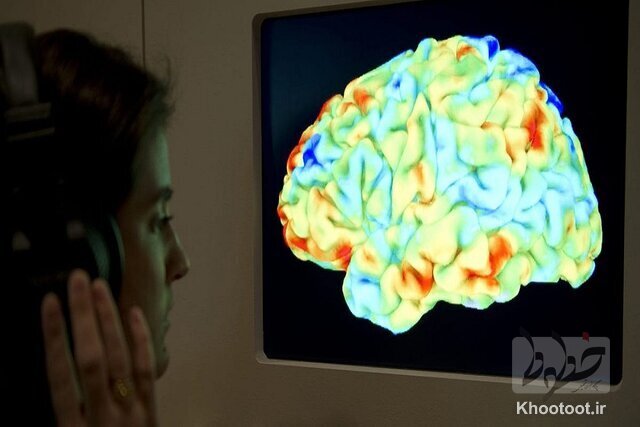 کشف نقش جدید ماده سفید مغز توسط محققان