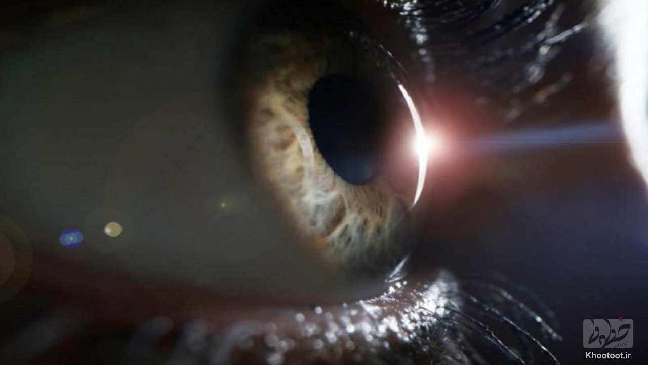 درمان مشکلات بینایی با تولید شبکیه مصنوعی در فضا