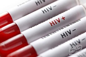 روابط جنسی بیشترین علت بروز HIV در ۱۴۰۱/ نیمی از مبتلایان در سنین ۲۵ تا ۳۹ سال