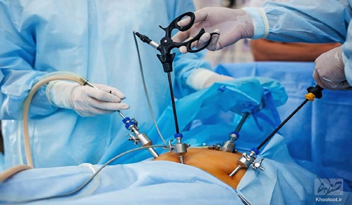 ایران دارای رتبه سوم جهان در جراحی چاقی!