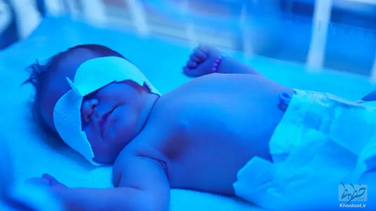 تولید دستگاهی جدید جهت درمان زردی نوزاد