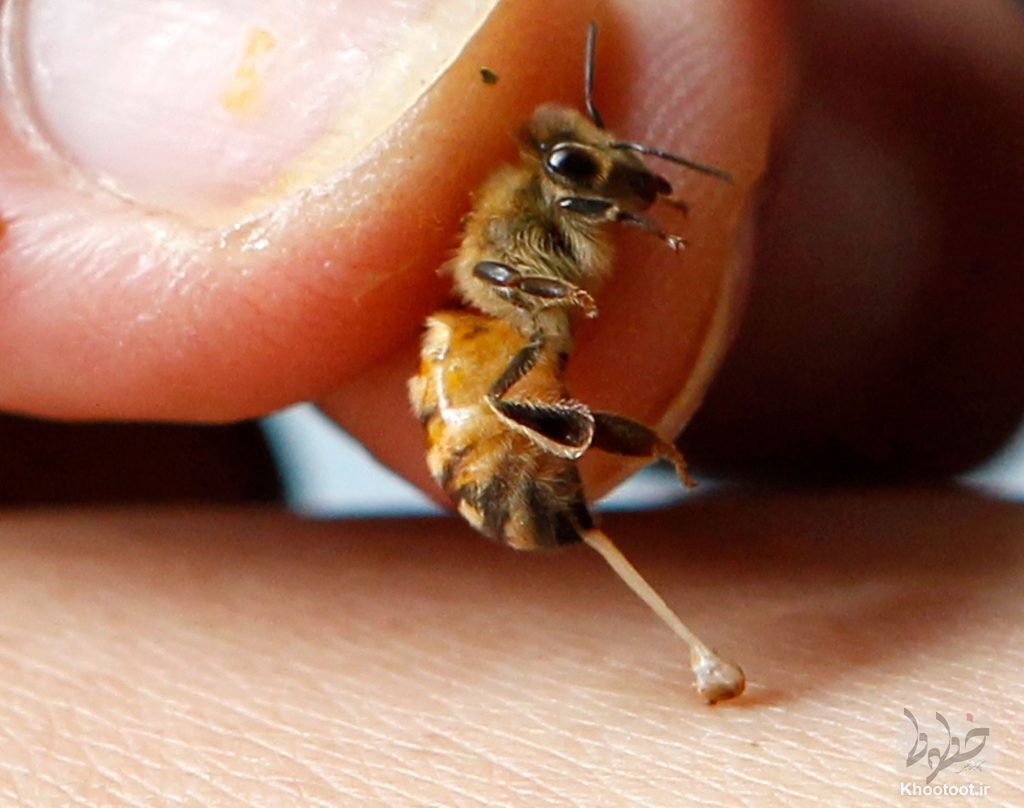 اثرات بالقوه‌ی زهر زنبور عسل بر روی بیماری پارکینسون