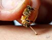 اثرات زهر زنبور عسل بر پارکینسون