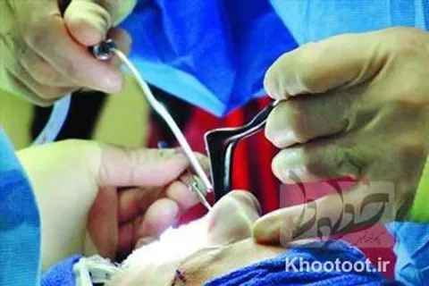 جراحی‌های زیبایی غیرمجاز، هرهفته موجب ۲ مرگ می‌شوند